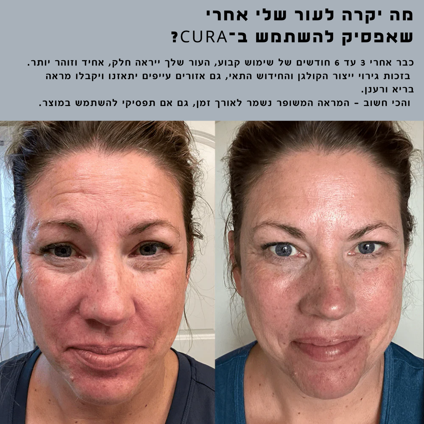 ערכת טיפול ושיקום לעור הפנים  CURA