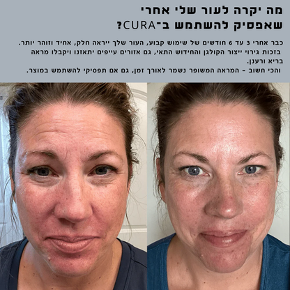 ערכת טיפול ושיקום לעור הפנים  CURA