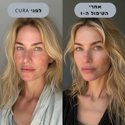 ערכת טיפול ושיקום לעור הפנים  CURA
